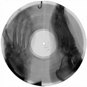 X-Ray records image gallery